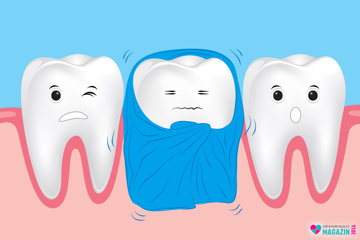 Eroze zubní skloviny naše zuby odhalí. Ty jsou pak nejen citlivé, ale i méně odolné zubním kazům. 