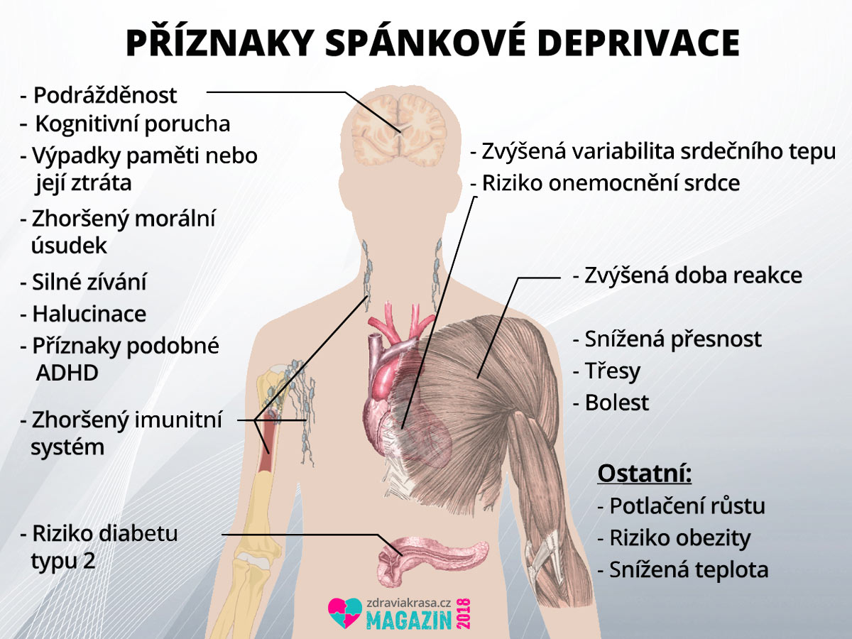 Zdroj: Poruchy spánku (Wikiskripta)