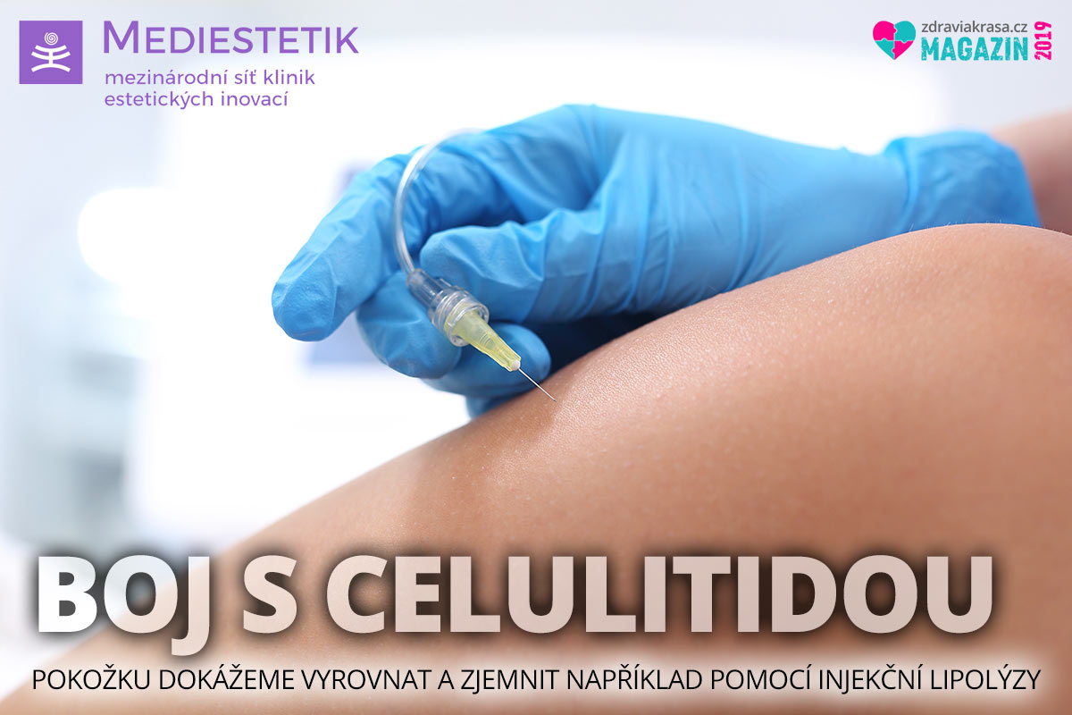 Injekční lipolýza je profesionální dermatologický zákrok, který umí rychle a účinně zmírnit příznaky celulitidy.