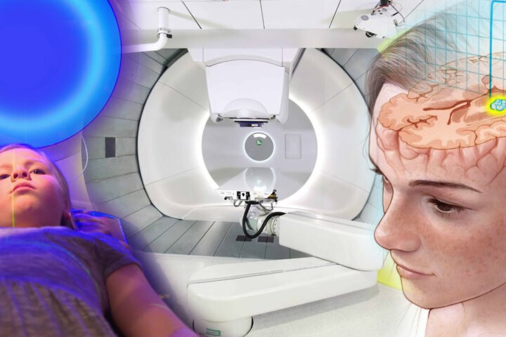 Léčba rakoviny protony je dostupná všem pacientům